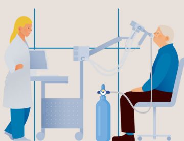Diffusion Capacity for Carbon Monoxide