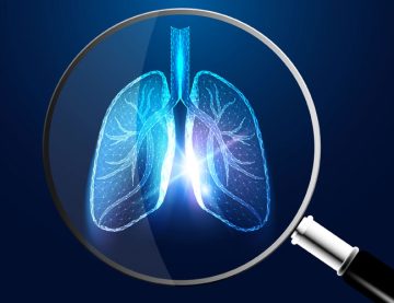 Lung Cancer